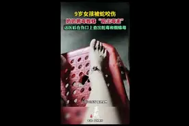 9岁女孩被蛇咬伤，奶奶抓毒蜘蛛“吸出毒素”，送医后在伤口上查出蛇毒和蜘蛛毒图片