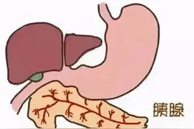如何辨别急性胰腺炎？图片