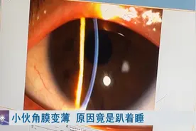 警惕！这样睡觉会影响视力，严重可失明！图片