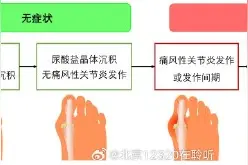 从高尿酸血症到痛风，就差这几步图片