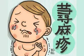 “风疙瘩”反复发作，怎么回事？松江医生：这些事项需注意丨健康智慧屋图片