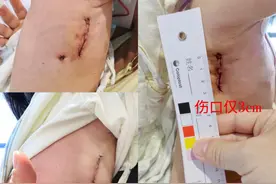 兄妹同日“修心”，夏季“修心”正当时图片