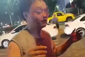 郑州警方回应代驾小哥被打：两行凶男子拘留15日图片