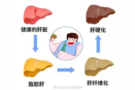 体检查出脂肪肝，不痛不痒不用管？图片