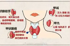 预防和早期发现甲状腺癌需要做到以下几点图片