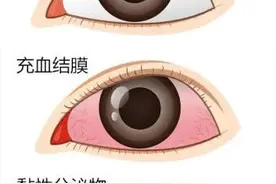 广州疾控提醒：暑期参加夏令营要警惕这些传染病图片