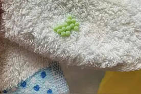 粘在睡衣上的虫卵怎么这么精致啊？图片