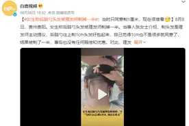 女子后脑勺头发被理发师剃掉一半：理发师提议剃1cm头发好包起来图片