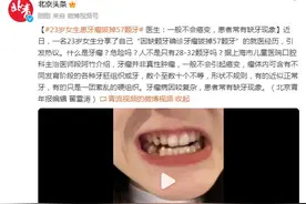 23岁女生患牙瘤拔掉57颗牙 医生：一般不会癌变图片