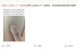手上出现这条“线”当心是癌？肿瘤医生：手指出现这3个变化一定要当心！图片