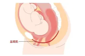 松江女性，关于盆底健康，你想了解的那些事儿→图片