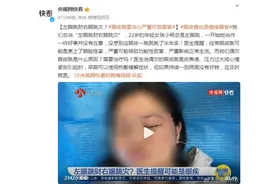 左眼跳财右眼跳灾？眼皮跳要当心严重可致眼盲图片