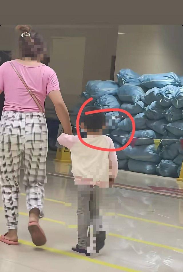 云南“头上插刀”女童淡定走进医院后续：已手术成功取刀 女童身体情况稳定