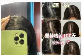 经常梳头vs不怎么梳头，到底哪种更健康？图片