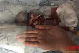 明明是双胞胎，出生时间竟然差3天？超早产姐妹花历经生死闯关终团圆图片