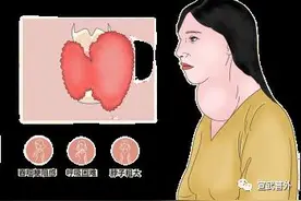 “甲亢”来势汹汹，你的心脏还好吗？图片