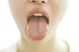 健康小站丨最近总感觉口干舌苦没胃口？这可能是身体发出的“警告”图片