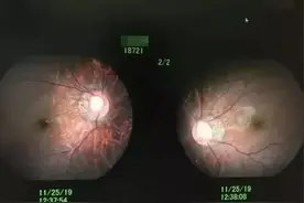 5岁娃近视1000度，罪魁祸首是它，几乎家家有！国庆假期要注意图片