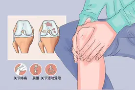 光华医生提醒：骨关节疾病应早治疗图片