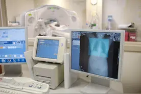 80%的肺癌患者与吸烟无关？！专家：40岁以上人群应筛查早期肺癌图片