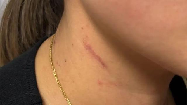 云南一男子怀疑妻子出轨凌晨逼问并施暴，被警方行拘4日，妇联：女方不调解坚决离婚，建议她起诉