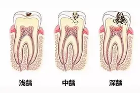预防蛀牙，从今天开始！图片