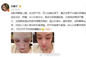 如何防止低温烫伤？图片