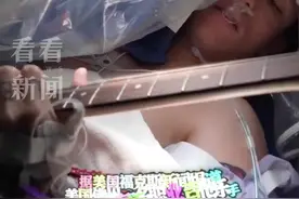 “脑洞大开”！美国小伙边做开颅手术边弹吉他图片