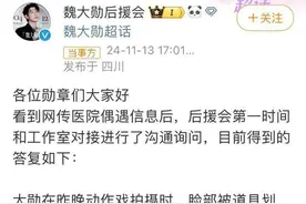 脸部被道具划伤！知名男星拍戏时突发意外图片
