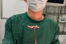 被鱼刺卡住第一时间如何自救？快来get正确处理方法图片