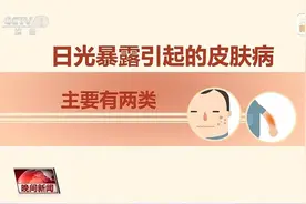 红肿、瘙痒……注意，你可能过敏啦！炎炎夏日，这些小知识请查收图片