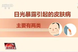 红肿、瘙痒……注意，你可能过敏啦！炎炎夏日，这些小知识请查收图片