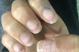 美甲变毁甲 如何守护“指尖上的美丽”？图片