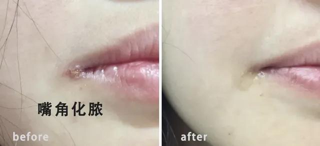 干唇人涂ta算是熬出头！轻薄滋润，一抹get嘟嘟唇，两支才几十块！