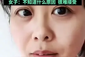 42岁女子20天内断崖式衰老，一觉醒来脸就垮了仿佛老了十几岁，女子：不知道什么原因 ，很难接受图片
