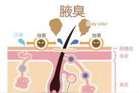 告别腋臭，重获清新人生图片