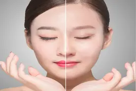 【健康科普】除皱针——一针破解岁月“皱”语图片