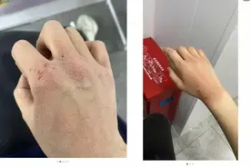 瑞幸被曝洗手流程致员工烂手！少洗1秒就扣分，有人甚至假装洗手图片