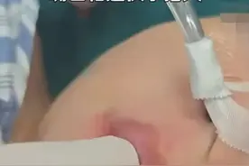 心疼！上海2岁幼童因误食致嘴巴灼伤粘连！这个东西很多人家里有图片