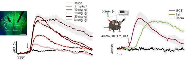 攻克抑郁症，北京重大突破！正开发新药