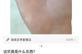 密密麻麻，很多人家中突然大量出现……紧急提醒→图片