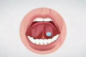 药师科普｜硝酸甘油片是甜的吗？图片