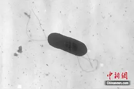 美多州暴发李斯特菌感染，已致12人死亡，“冰箱杀手”李斯特菌该如何预防？图片