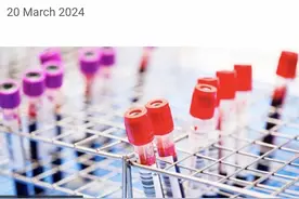 科学家成功清除已感染的HIV病毒，所用基因编辑技术曾获诺奖图片