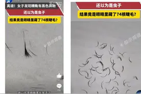 女子一次掉落74根眼睫毛！提醒：可能与螨虫感染、种植假睫毛等有关|网红说法求真图片