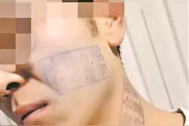 小伙猪肉印章盖脸上，时隔五天终于洗掉，称：不要模仿图片