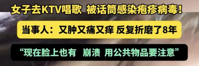 紧急扩散！KTV惊现“疱疹病毒”！又肿又疼又痒，一旦感染难根治！