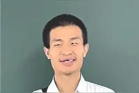 北大“韦神”掉牙引热议 数科学院:已有治疗方案图片