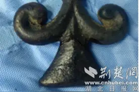 18岁少年被栏杆刺穿肩膀 国药东风总医院紧急施救成功脱险图片