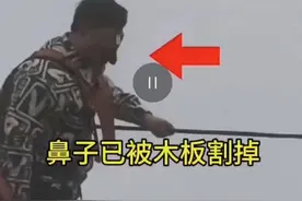 游客贵州铜仁玩“步步惊心”桥鼻子被割？当地文旅局：未割掉是磕破了，已送医图片